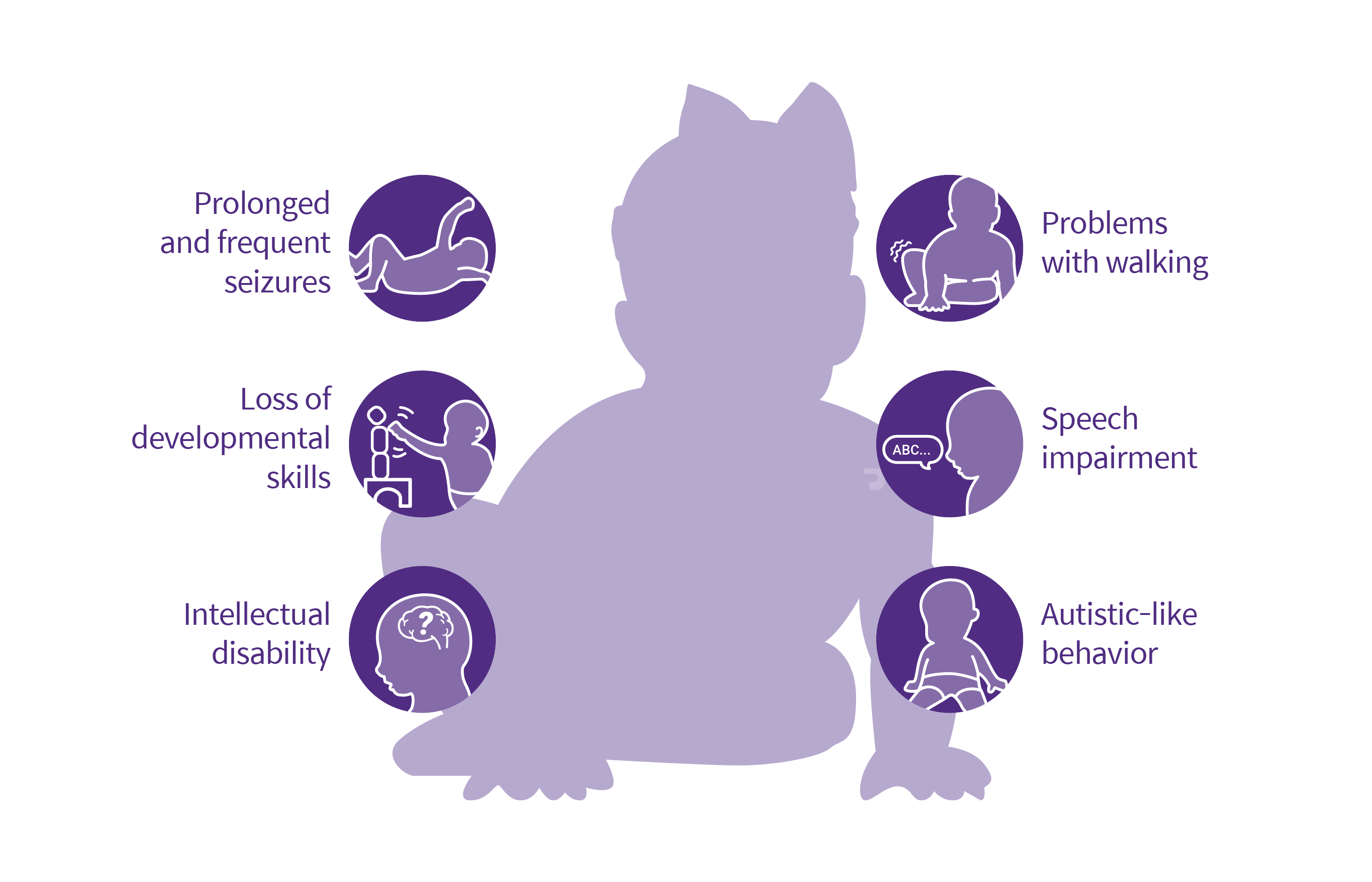 Six symptoms of Dravet syndrome: Prolonged and frequent seizures, loss of developmental skills, intellectual disability, problems with walking, speech impairment, autistic-like behavior