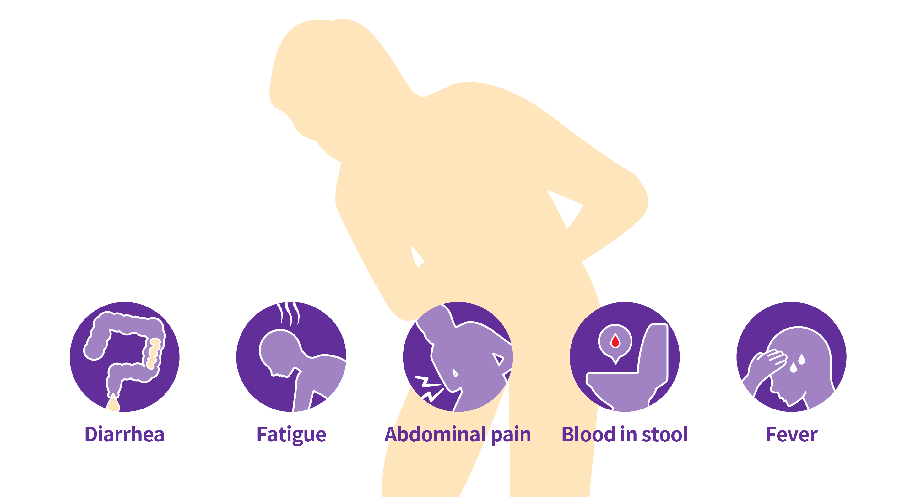Five major symptoms of Crohn's disease: diarrhea, fatigue, abdominal pain, blood in stool, fever