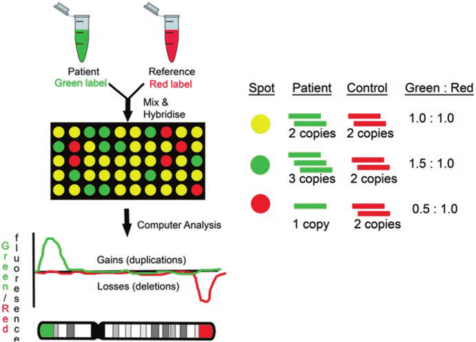 Comparative-genome-hybridization-CGH-microarray-Karampetsou-et-al-2014